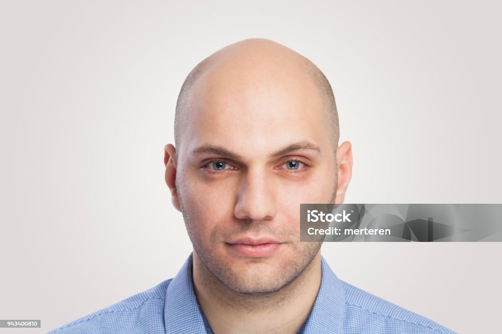 Bald Man Head Shot Looking At Camera With Blank Facial Expression Stock ...