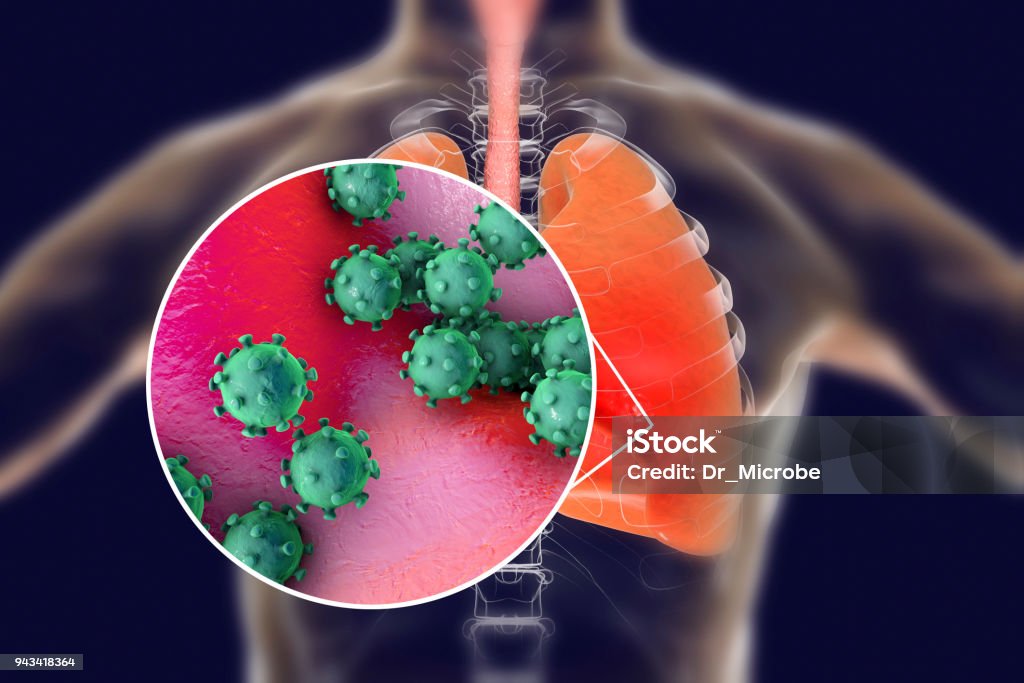 Viruses in human lungs Viruses in human lungs, 3D illustration. Conceptual image for viral pneumonia, flu, MERS-CoV, SARS, Adenoviruses and other respiratory viruses Infectious Disease Stock Photo
