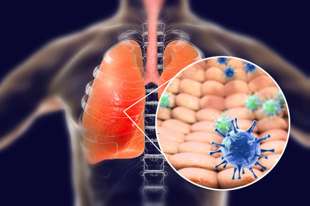 Viruses in human lungs Viruses in human lungs, 3D illustration. Conceptual image for viral pneumonia, flu, MERS-CoV, SARS, Adenoviruses and other respiratory viruses animal lung stock pictures, royalty-free photos & images
