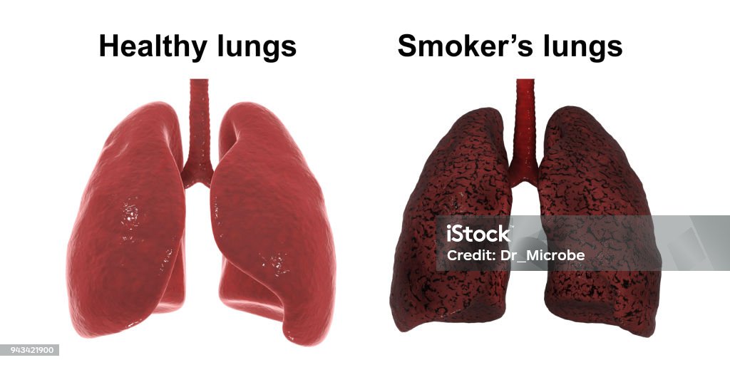 Poumons de fumeur isolés sur fond blanc, notion médicale et en santé - Photo de Anatomie libre de droits
