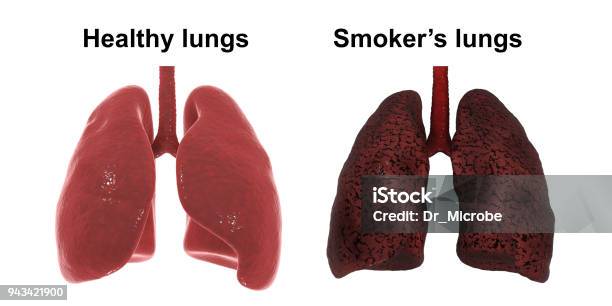 Healthy And Smokers Lungs Isolated On White Background Medical Concept Stock Photo - Download Image Now