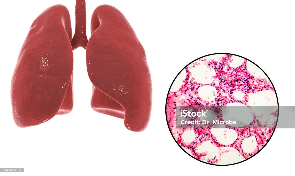 Histología y anatomía de los pulmones - Foto de stock de Anatomía libre de derechos