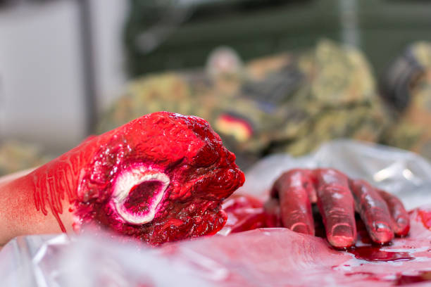 istock an amputated hand on a german soldier 943920518