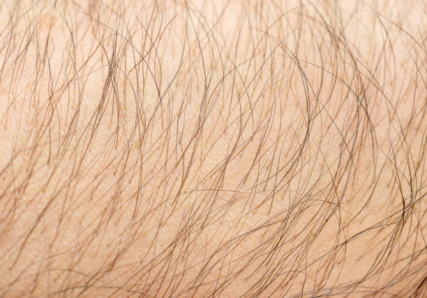 textura de pele humana com cabelo. close-up. - cabeludo - fotografias e filmes do acervo