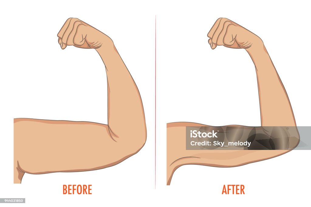 Female biceps before and after sport. Arms showing progress afte Female biceps before and after sport. Arms showing progress after fitness. Bent arm with bat wing vs well toned arm. Vector illustration for beauty, cosmetology, sport or medicine infographic. Arm stock vector