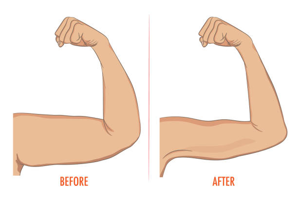 Female biceps before and after sport. Arms showing progress afte Female biceps before and after sport. Arms showing progress after fitness. Bent arm with bat wing vs well toned arm. Vector illustration for beauty, cosmetology, sport or medicine infographic. fat bat stock illustrations