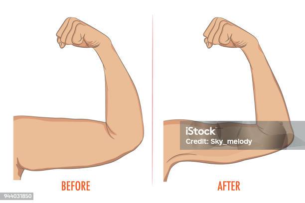 Female Biceps Before And After Sport Arms Showing Progress Afte Stock Illustration - Download Image Now