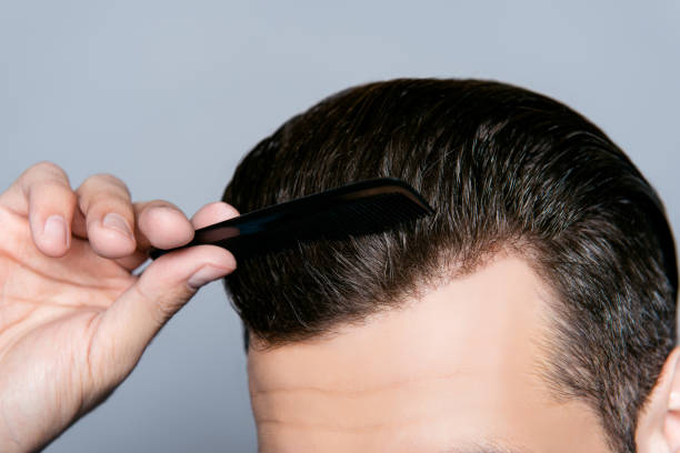 крупным планом руки человека расчесывать волосы без перхоть - men human hair washing hairdresser стоковые фото и изображения