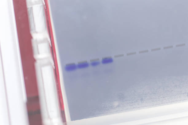 l'elettroforesi del gel di agarosio è un metodo di elettroforesi gel usato in biochimica, biologia molecolare, genetica e chimica clinica in laboratorio. - dna sequencing gel foto e immagini stock