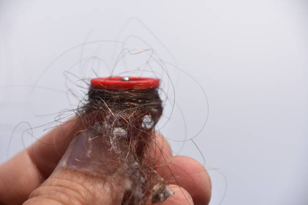 istock Human hair And dirt Stuck 944179834