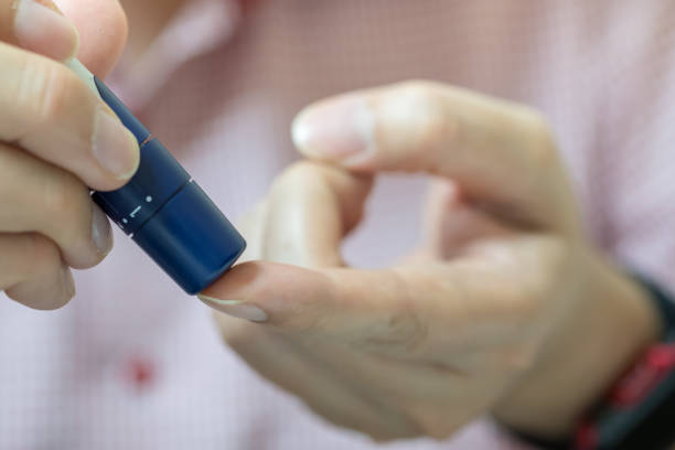 istock Close up of man hands using lancet on finger to check blood sugar level by Glucose meter using as Medicine, diabetes, glycemia, health care and people concept. 944270336