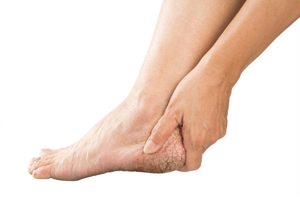 istock heel muscle pain 944519814
