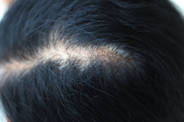 istock Close up gray hair roots woman 944707708