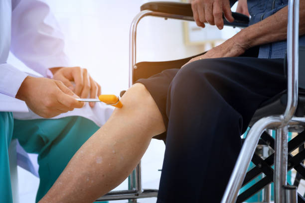 doctor checks the patient's reflexes. Neurologist Hammer for knocking knee jerk, Medical equipment for physical examination doctor checks the patient's reflexes. Neurologist Hammer for knocking knee jerk, Medical equipment for physical examination rubber mallet stock pictures, royalty-free photos & images