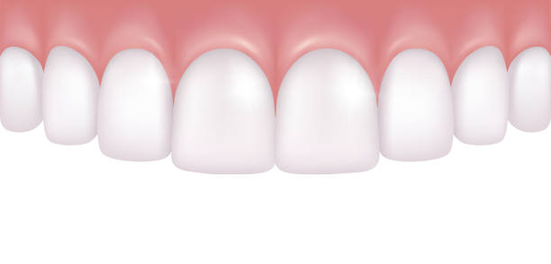 ilustrações de stock, clip art, desenhos animados e ícones de vector realistic row of white and atraight upper teeth - dentistry medical model - gums