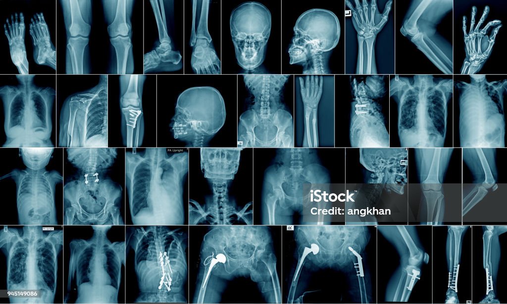 collection x-ray multiple area high quality x-ray collection body part and fracture area Medical X-ray Stock Photo