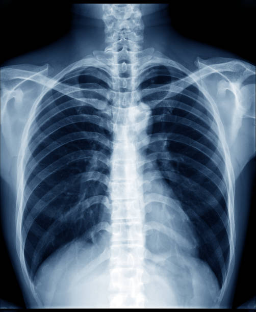 普通の健康な男の胸部 x 線写真を示す肺、心臓、背骨、鎖骨、ダイヤフラム - human spine anatomy x ray the human body ストックフォトと画像