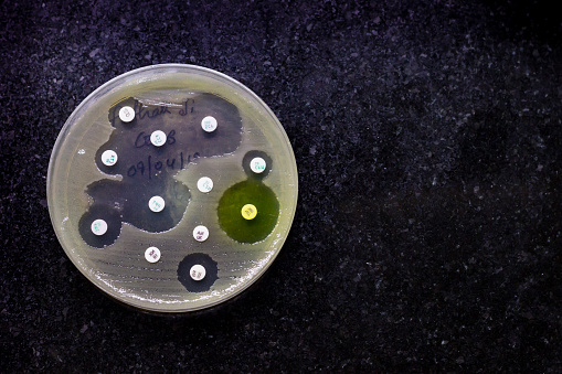 Top View of Culture plate of bacterial growth showing antibiotic sensitivity in their colony pattern placed on mosaic black background