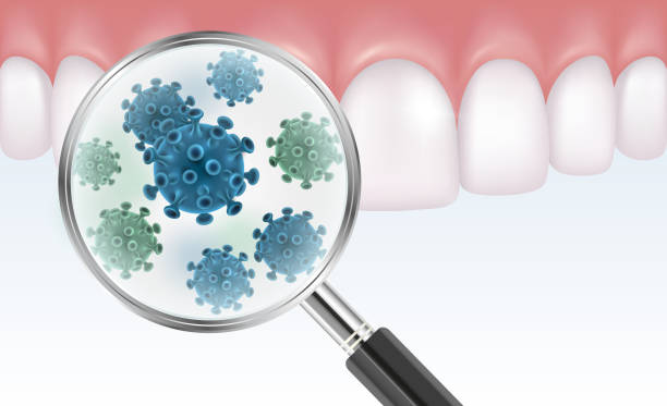 ilustraciones, imágenes clip art, dibujos animados e iconos de stock de ilustración realista vector de dientes con lupa que muestra bacterias - plaque