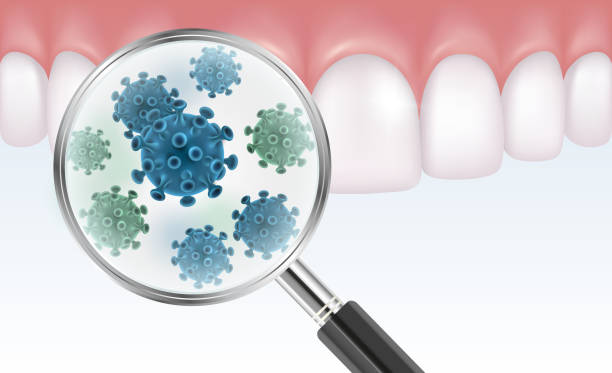 illustrazioni stock, clip art, cartoni animati e icone di tendenza di illustrazione vettoriale realistica dei denti con lente d'ingrandimento che mostra i batteri - usare la bocca