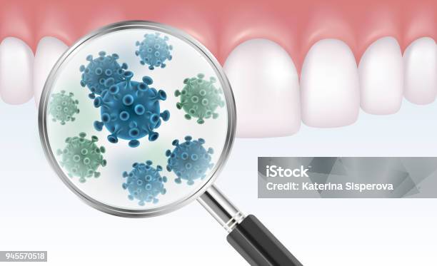 細菌を示す拡大鏡で歯のベクトルのリアルなイラスト - バクテリアのベクターアート素材や画像を多数ご用意 - バクテリア, 口, プラーク