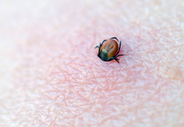 The tick sucked into the human skin. The tick sucked into the human skin. Macrophotograpy. lyme disease photos stock pictures, royalty-free photos & images