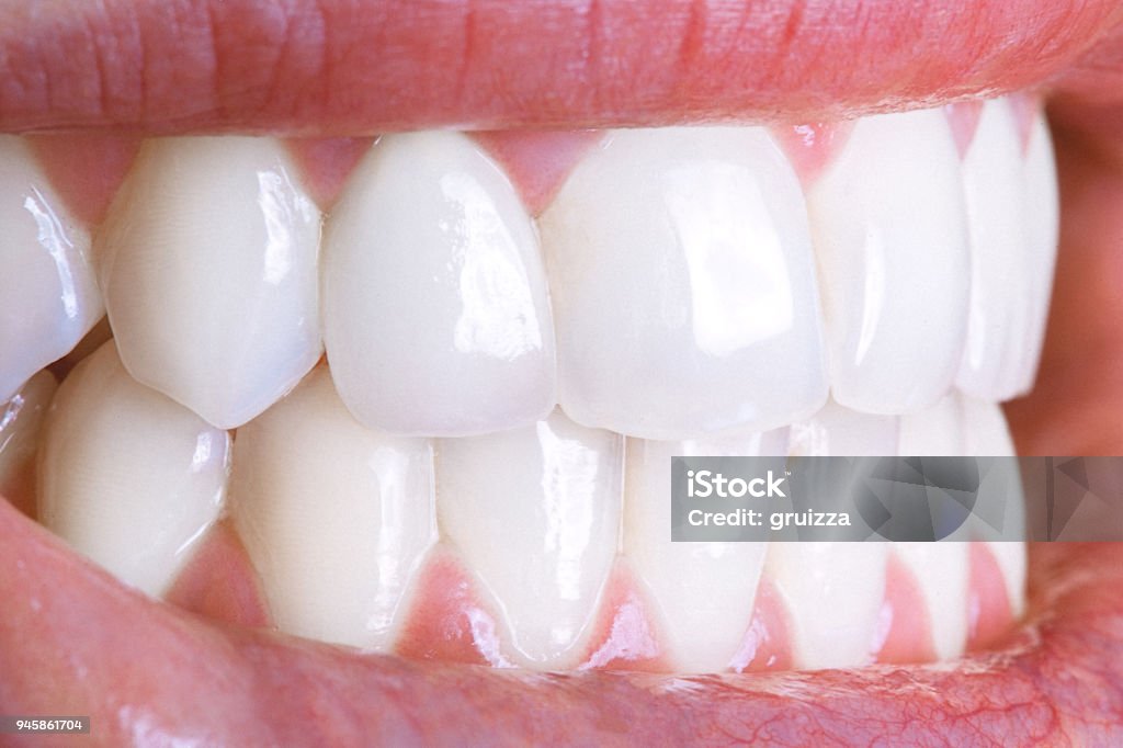 Close-up of a shiny white human teeth Teeth Stock Photo
