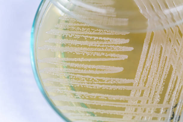 Research of Bacterial and fungi in Petri dishes in laboratories for education in lab. Research of Bacterial and fungi in Petri dishes in laboratories for education in lab. yeast cells stock pictures, royalty-free photos & images