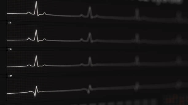 istock ECG waves on monitor in perspective with DOF 946355458