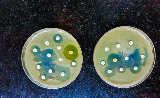 two culture media plate showing bacterial growth inhibition antibacterial sensitivity
