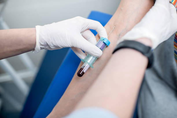 istock Woman taking blood for test in the laboratory 946491656