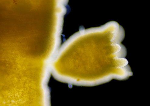 Green hydra (Hydra viridissima) young polyp (retracted). Darkfield illumination.