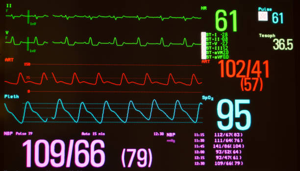 istock Monitor Showing Intraventricular Conduction Delay and Vital Signs 946665358