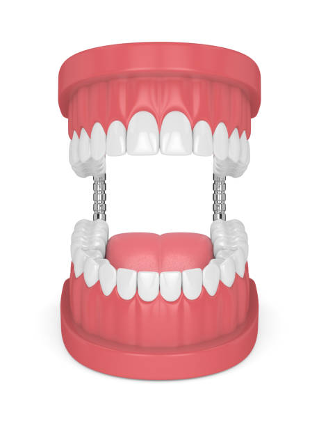 istock 3d render of jaw model with teeth over white 946768656