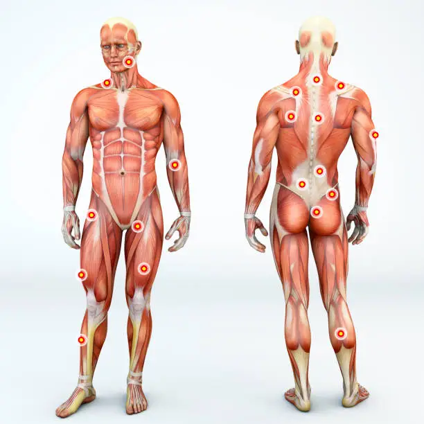Photo of Myofascial trigger points, are described as hyperirritable spots in the fascia surrounding skeletal muscle. Palpable nodules in taut bands of muscle fibers. Front and back view of a man. 3d rendering