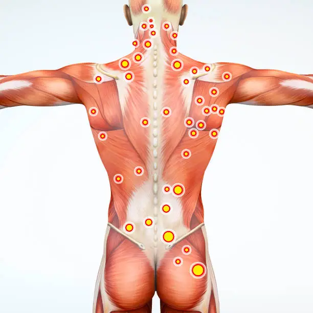 Photo of Back view of a man and his trigger points. Anatomy muscles. 3d rendering