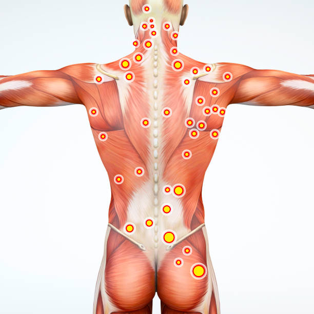 vista traseira de um homem e seus pontos de gatilho. músculos de anatomia. renderização 3d - physical therapy - fotografias e filmes do acervo