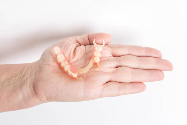 flexible nylon denture flexible nylon denture on female hand. Removable dentures flexible, devoid of nylon, hypoallergenic exempt from monomer incomplete stock pictures, royalty-free photos & images