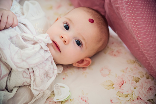 Adorable and expressive baby girl with a strawberry mark out hemangiona with a heart shape on forehead. She is waking up from a nap, looking at the camera. Horizontal headshot indoors with copy space.