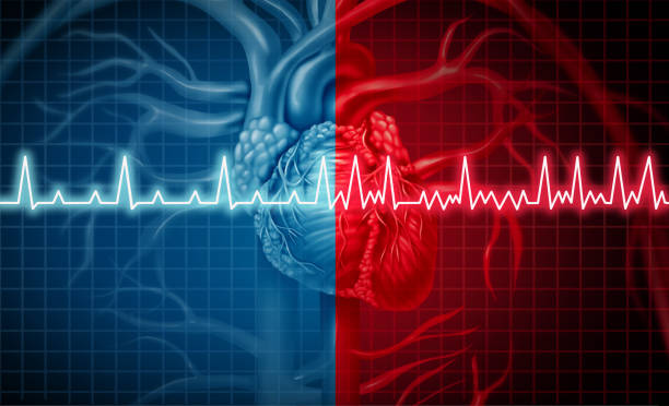 la fibrilación auricular - fibrillation fotografías e imágenes de stock