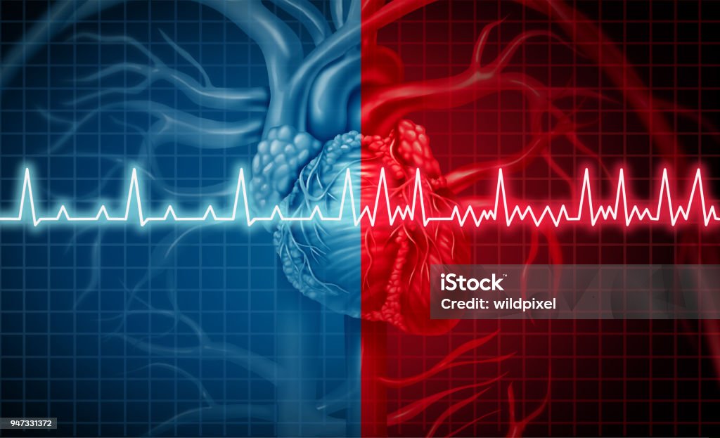 Atrial Fibrillation Atrial fibrillation and normal or abnormal heart rate rythm concept as a cardiac disorder as a human organ with healthy and unhealthy ecg monitoring in a 3D illustration style. Atrial Fibrillation Stock Photo