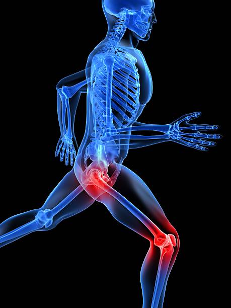 bolesne stawów - x ray human knee orthopedic equipment human bone zdjęcia i obrazy z banku zdjęć