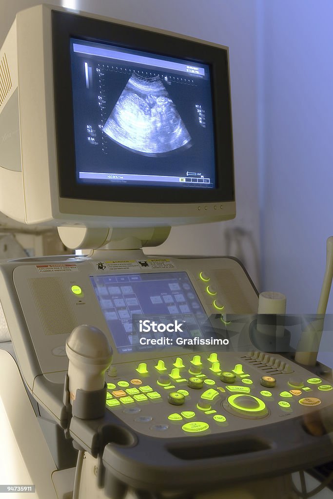 超音波装置、画像の病院 - 医療機器のロイヤリティフリーストックフォト