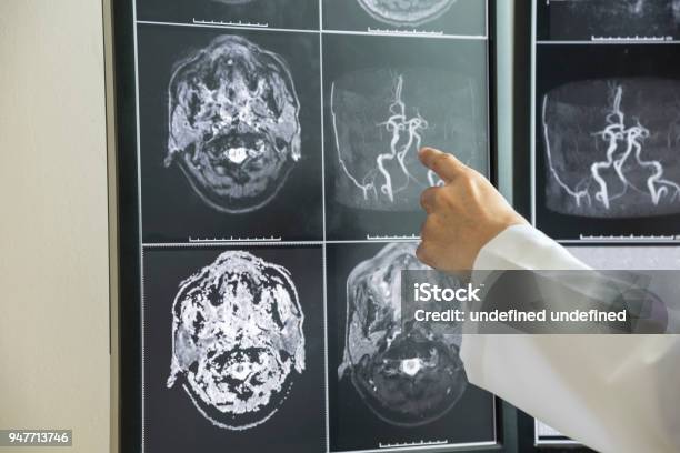 Doctor Pointing To Brain Anatomy On Mri Image Stock Photo - Download Image Now - Technology, Adult, Adults Only