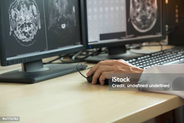 Doctor Looking At Mri In Computer Monitor Stock Photo - Download Image Now - Radiologist, Medical X-ray, Oncology