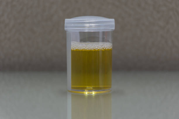 Urine sample testing in plastic bottle for examination in laboratory hospital stock photo