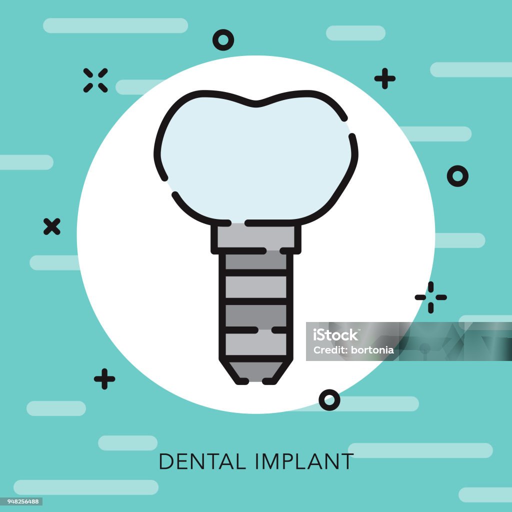 Dental Implant Open Outline Dentist Icon A flat design/thin line icon with small openings in the outlines to add some character. Color swatches are global so it’s easy to edit and change the colors. File is built in CMYK for optimal printing and the background is on a separate layer. Canada stock vector