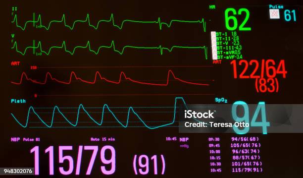 Close Up Of Heart Monitor With Paced Rhythm And Sinus Bradycardia Stock Photo - Download Image Now