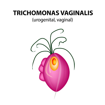 Trichomonas vaginalis structure. Trichomoniasis. Urogenital infection. Infographics. Vector illustration on isolated background