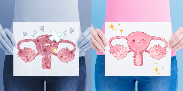 istock woman take uterus billboard 948415484